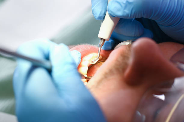 Best Weekend Emergency Dental Services in Hope Mills, NC